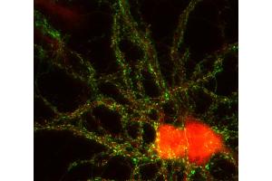 Immunocytochemistry (ICC) image for anti-Calcium Channel, Voltage-Dependent, gamma Subunit 3 (CACNG3) (AA 294-307) antibody (ABIN1742512)