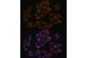 Immunofluorescence analysis of U-2 OS cells using SNX1 Rabbit pAb (ABIN6128725, ABIN6148234, ABIN6148235 and ABIN6224727) at dilution of 100 (40x lens). (Sorting Nexin 1 anticorps  (AA 1-150))