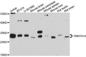 Western blot analysis of extracts of various cell lines, using TRMT61A antibody (ABIN5999106) at 1/1000 dilution. (TRMT61A anticorps)