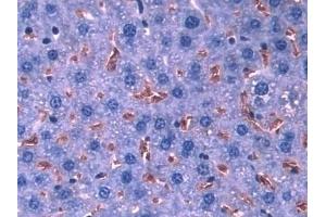 Detection of HBa1 in Mouse Liver Tissue using Polyclonal Antibody to Hemoglobin Alpha 1 (HBa1)