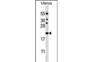 CDKN1B Antibody (C-term) (ABIN657225 and ABIN2846327) western blot analysis in human normal Uterus tissue lysates (35 μg/lane).