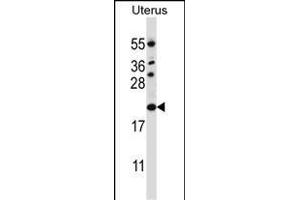 CDKN1B Antibody (C-term) (ABIN657225 and ABIN2846327) western blot analysis in human normal Uterus tissue lysates (35 μg/lane). (CDKN1B anticorps  (C-Term))