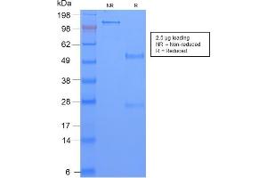 anti-TAG-72 / CA72.4 antibody