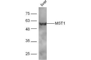 Mouse liver lysates probed with Rabbit Anti-MST1 Polyclonal Antibody, Unconjugated  at 1:5000 for 90 min at 37˚C. (MST1 anticorps  (AA 385-487))