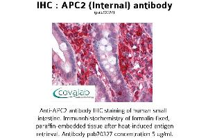 Image no. 2 for anti-APC Regulator of WNT Signaling Pathway 2 (APC2) (Internal Region) antibody (ABIN1731845) (APC2 anticorps  (Internal Region))