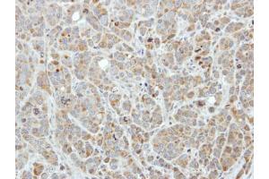 IHC-P Image Immunohistochemical analysis of paraffin-embedded MCF7 xenograft, using Edc3, antibody at 1:250 dilution. (EDC3 anticorps  (Internal Region))