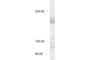 dilution: 1 : 1000, sample: synaptic membrane fraction of rat brain (LP1) (Neurexin 3 anticorps  (AA 1298-1494))