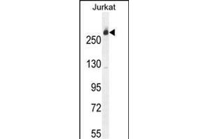 CAD Antibody (Center) (ABIN655062 and ABIN2844692) western blot analysis in Jurkat cell line lysates (35 μg/lane).
