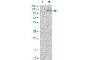 Western Blot analysis of Lane 1: negative control (vector only transfected HEK293T cell lysate) and Lane 2: over-expression lysate (co-expressed with a C-terminal myc-DDK tag in mammalian HEK293T cells) with ADAM15 polyclonal antibody . (ADAM15 anticorps)