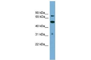 TLK2 antibody used at 0. (TLK2 anticorps  (N-Term))