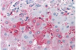 anti-Dual Specificity Phosphatase 26 (DUSP26) (Internal Region) antibody