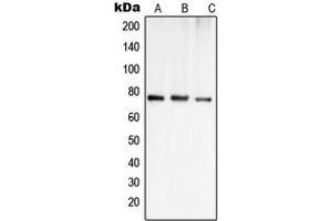 Western blot analysis of OATP1 expression in Jurkat (A), MCF7 (B), SHSY5Y (C) whole cell lysates. (SLCO1A2 anticorps  (Center))