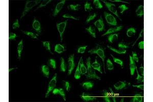 Immunofluorescence of monoclonal antibody to TOMM20 on HeLa cell. (TOMM20 anticorps  (AA 1-145))
