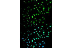 Immunofluorescence analysis of MCF7 cell using CD27 antibody. (CD27 anticorps  (AA 20-191))