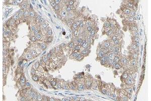 ABIN6278831 at 1/100 staining Human prostate tissue by IHC-P. (ADCY7 anticorps  (Internal Region))
