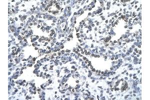 Rabbit Anti-ZNF212 antibody   Paraffin Embedded Tissue: Human Lung cell Cellular Data: alveolar cell of renal tubule Antibody Concentration: 4. (ZNF212 anticorps  (N-Term))
