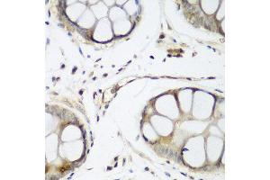 Immunohistochemistry of paraffin-embedded human gastric using WWTR1 antibody at dilution of 1:200 (40x lens). (WWTR1 anticorps)