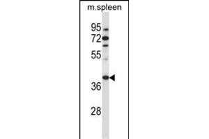 TBCC Antibody (N-term ) (ABIN657398 and ABIN2846438) western blot analysis in mouse spleen tissue lysates (35 μg/lane). (TBCC anticorps  (N-Term))
