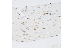 Immunohistochemistry of paraffin-embedded human stomach using CSRP3 Antibody (ABIN2562048) at dilution of 1:100 (40x lens). (CSRP3 anticorps)