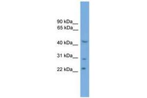 Image no. 1 for anti-MOK Protein Kinase (MOK) (AA 251-300) antibody (ABIN6746468) (MOK anticorps  (AA 251-300))