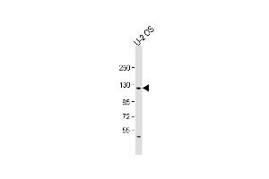 Anti-LIFR Antibody (C-term) at 1:2000 dilution + U-2OS whole cell lysate Lysates/proteins at 20 μg per lane. (LIFR anticorps  (C-Term))