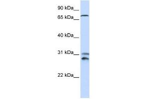 TLK2 antibody used at 1 ug/ml to detect target protein. (TLK2 anticorps  (N-Term))
