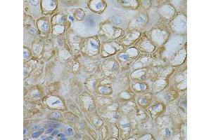 Immunohistochemistry of paraffin-embedded Human esophagus using DEFB132 Polyclonal Antibody at dilution of 1:100 (40x lens). (DEFB132 anticorps)
