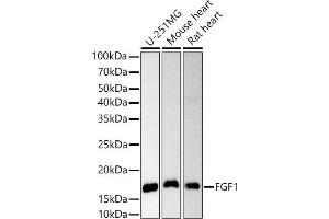 Western blot analysis of extracts of various cell lines, using FGF1 antibody (ABIN3021072, ABIN3021073, ABIN3021074 and ABIN6213939) at 1:1000 dilution. (FGF1 anticorps  (AA 16-155))