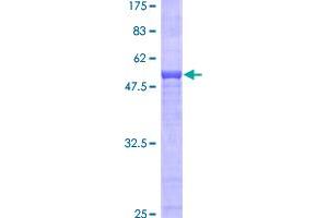 Image no. 1 for alpha-2-Glycoprotein 1, Zinc-Binding (AZGP1) (AA 1-298) protein (GST tag) (ABIN1346255)