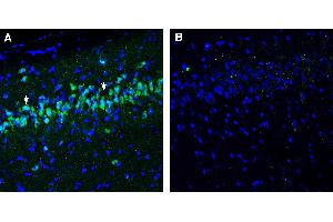 Expression of NPFFR1 in rat hippocampus. (NPFFR1 anticorps  (Extracellular))