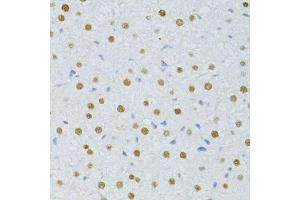 Immunohistochemistry of paraffin-embedded rat liver using SNRNP70 antibody.