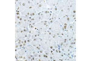 Immunohistochemistry of paraffin-embedded mouse pancreas using GB Rabbit pAb (ABIN6127943, ABIN6140978, ABIN6140979 and ABIN6225075) at dilution of 1:100 (40x lens). (GATAD2B anticorps  (AA 1-120))