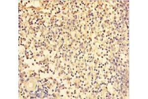 Immunohistochemistry of paraffin-embedded human spleen tissue using ABIN7172243 at dilution of 1:100 (TRAF5 anticorps  (AA 1-557))