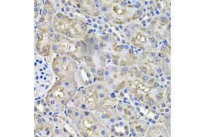 Immunohistochemistry of paraffin-embedded rat kidney using ACO1 antibody at dilution of 1:100 (x40 lens). (Aconitase 1 anticorps)