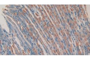 Detection of CHEM in Mouse Stomach Tissue using Polyclonal Antibody to Chemerin (CHEM) (CHEM (AA 21-155) anticorps)