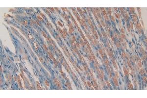 Detection of CHEM in Mouse Stomach Tissue using Polyclonal Antibody to Chemerin (CHEM) (Chemerin anticorps  (AA 21-155))