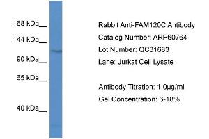 Western Blotting (WB) image for anti-Family with Sequence Similarity 120C (FAM120C) (N-Term) antibody (ABIN2788566) (FAM120C anticorps  (N-Term))