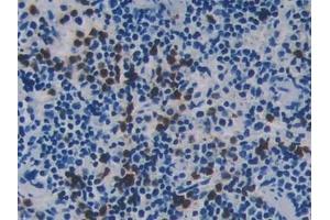 Detection of RIPK3 in Mouse Spleen Tissue using Polyclonal Antibody to Receptor Interacting Serine Threonine Kinase 3 (RIPK3)