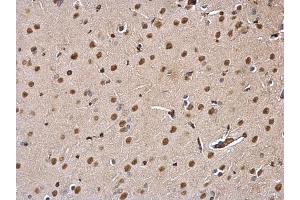 IHC-P Image DDB1 antibody detects DDB1 protein at nucleus and cytosol on rat fore brain by immunohistochemical analysis. (DDB1 anticorps  (C-Term))