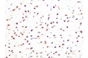 Immunohistochemistry of paraffin-embedded rat brain using PRMT1 Rabbit mAb  at dilution of 1:100 (40x lens).