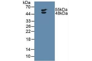 Detection of LTbR in Human U-87MG Cells using Polyclonal Antibody to Lymphotoxin Beta Receptor (LTbR) (LTBR anticorps  (AA 66-215))