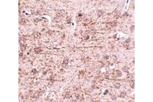 Immunohistochemistry (IHC) image for anti-Zinc Finger and BTB Domain Containing 1 (ZBTB1) (Middle Region) antibody (ABIN1031169) (ZBTB1 anticorps  (Middle Region))