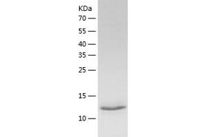 Western Blotting (WB) image for Leptin (LEP) (AA 22-167) protein (His-IF2DI Tag) (ABIN7123744)