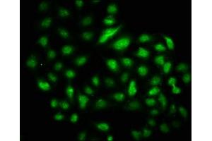 Immunofluorescence staining of Hela cells with ABIN7150197 at 1:133, counter-stained with DAPI. (DMAP1 anticorps  (AA 250-300))
