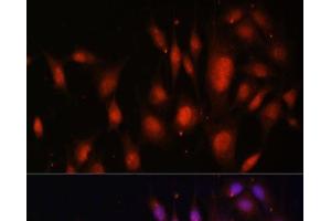 Immunofluorescence analysis of NIH/3T3 cells using TFEB Polyclonal Antibody at dilution of 1:100. (TFEB anticorps)