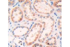 IHC-P analysis of Human Tissue, with DAB staining. (Talin anticorps  (AA 975-1181))