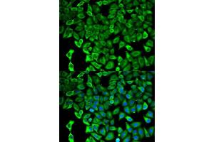 Immunofluorescence analysis of HeLa cells using PSMD2 antibody.