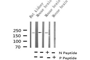 Western blot analysis of Phospho-Tuberin/TSC2 (Thr1462) Antibody expression in mouse brain and rat kidney tissues lysates. (Tuberin anticorps  (pThr1462))