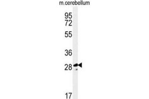 Western Blotting (WB) image for anti-Tescalcin (TESC) antibody (ABIN3002247) (Tescalcin anticorps)
