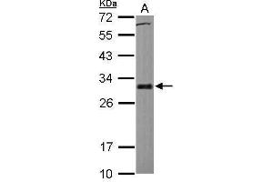 WB Image Sample (30 ug of whole cell lysate) A: HCT116 12% SDS PAGE antibody diluted at 1:1000 (BCL2L1 anticorps)